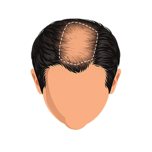 Stage 5