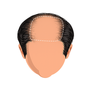 Stage 6