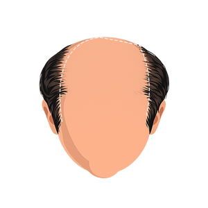 Stage 7